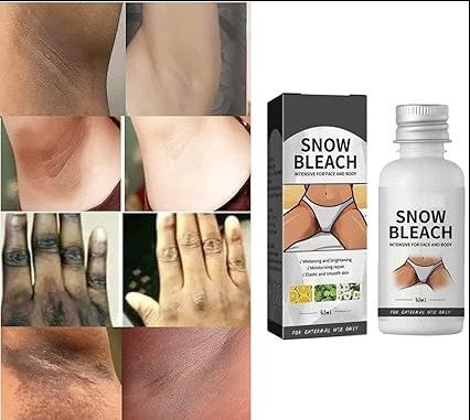 Dark Spot Remover Cream